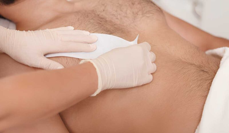 Erkek ağda — göğüs ve sırt bölgesi profesyonel ağda uygulaması